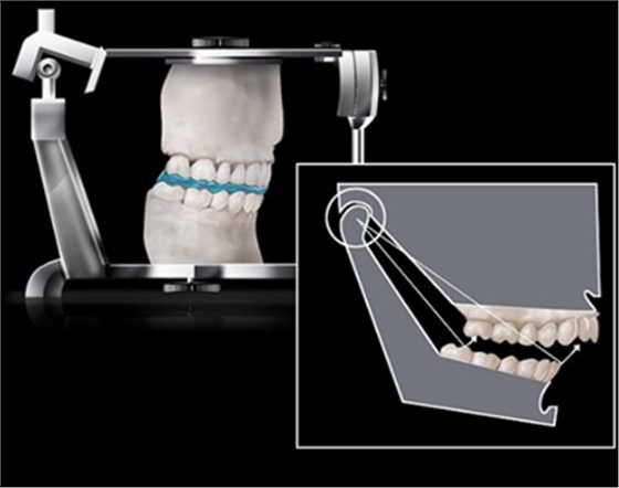 如何利用垂直距離解決好臨床問(wèn)題 如何利用垂直距離解決好臨床問(wèn)題