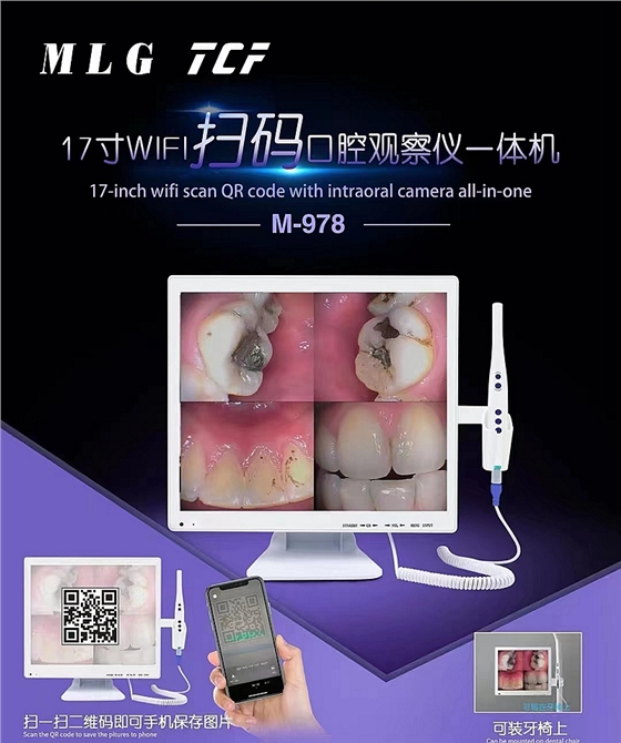 美力光內(nèi)窺鏡 美力光內(nèi)窺鏡