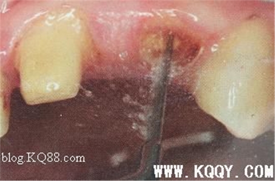 點(diǎn)擊瀏覽下一頁