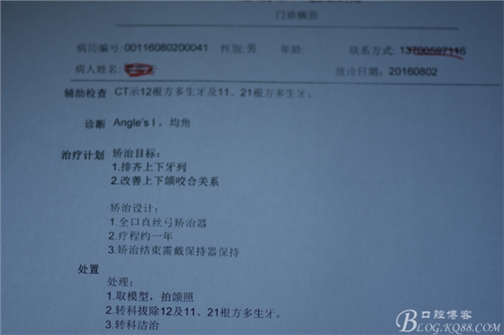 雙切口拔除鼻底埋伏多生牙 雙切口拔除鼻底埋伏多生牙