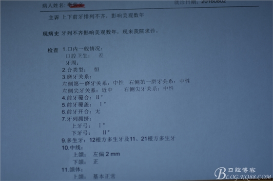 雙切口拔除鼻底埋伏多生牙 雙切口拔除鼻底埋伏多生牙