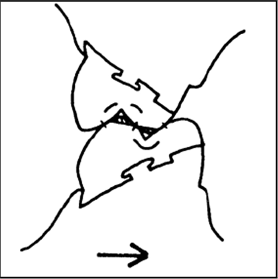 upfile 修復(fù)進(jìn)修醫(yī)生常見問題(全口義齒)-圖8-2.bmp