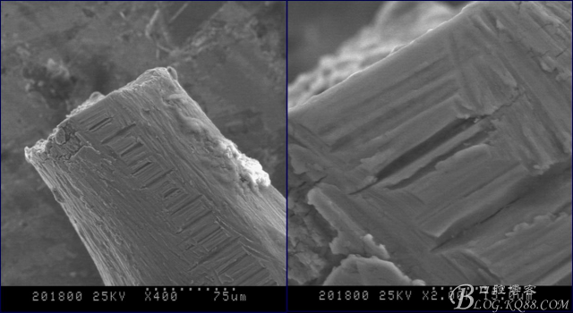 彭彬:鎳鈦根管器械折斷的類型及預防要點(修改版) 彭彬:鎳鈦根管器械折斷的類型及預防要點(修改版)