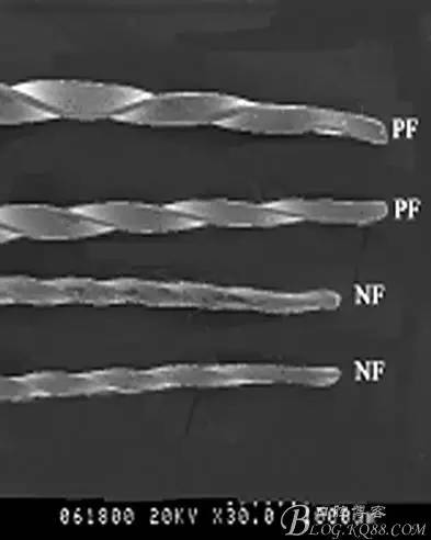 彭彬:鎳鈦根管器械折斷的類型及預防要點(修改版) 彭彬:鎳鈦根管器械折斷的類型及預防要點(修改版)