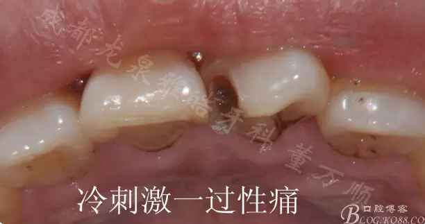 QQ圖片20150710100650.png QQ圖片20150710100650.png