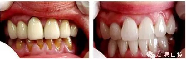 QQ圖片20150710105852.png QQ圖片20150710105852.png