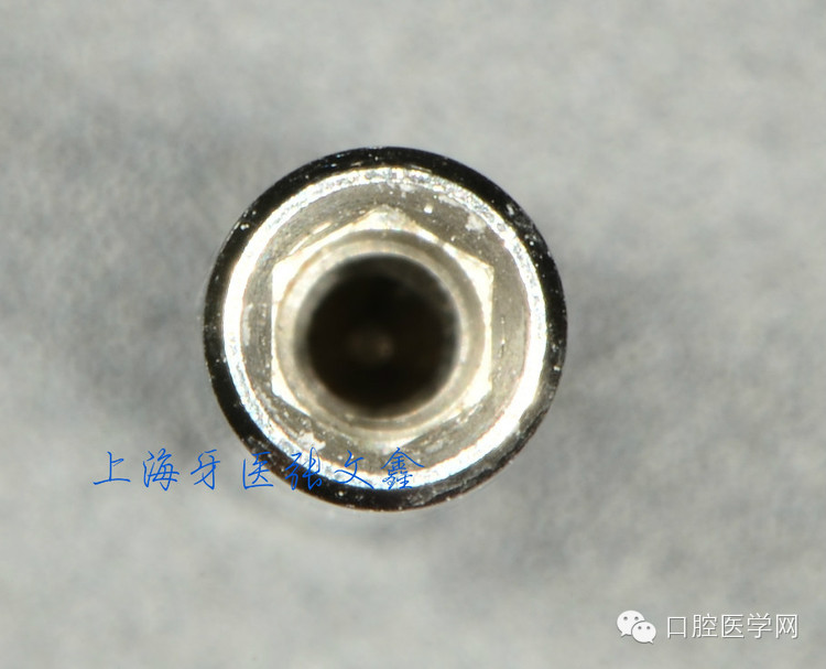 種植替代體上的細節(jié)不可忽視 種植替代體上的細節(jié)不可忽視