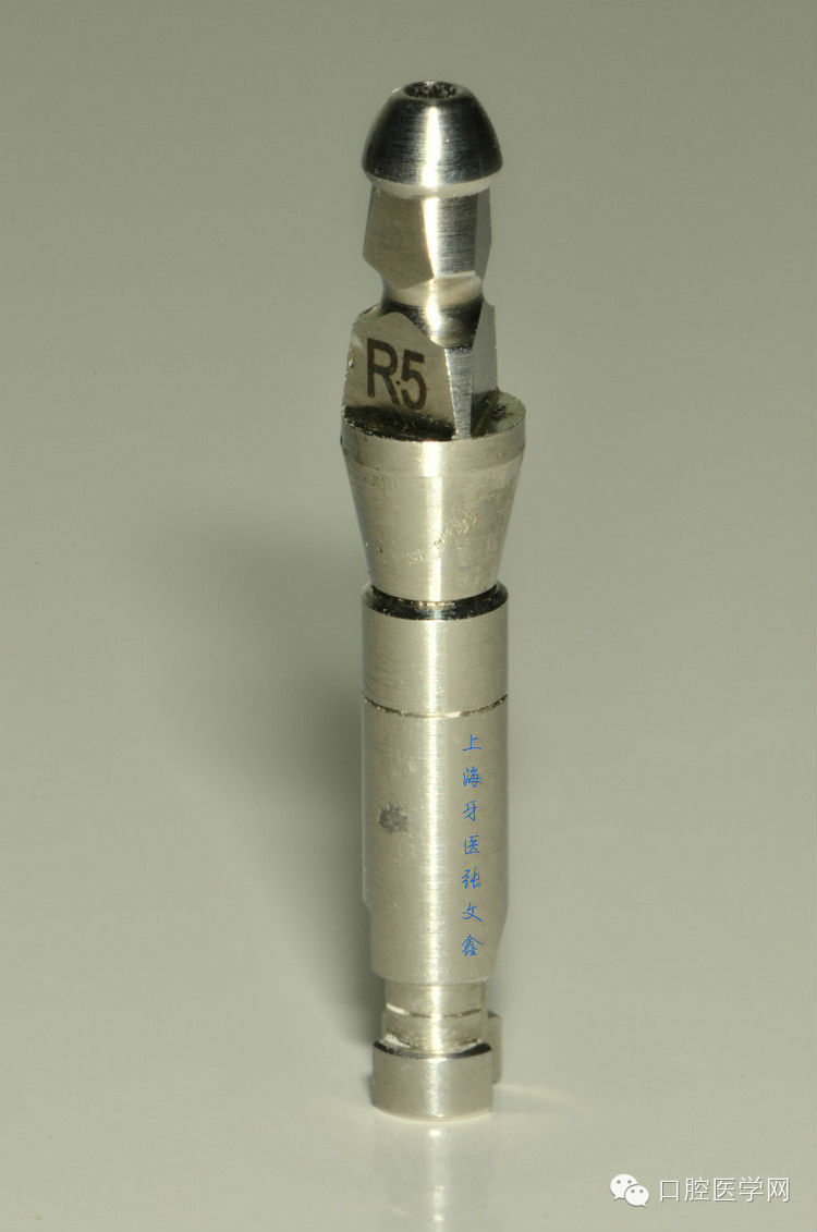 種植替代體上的細節(jié)不可忽視 種植替代體上的細節(jié)不可忽視