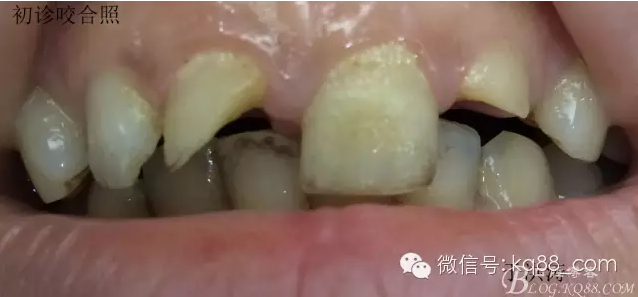 QQ圖片20150711104808.png QQ圖片20150711104808.png