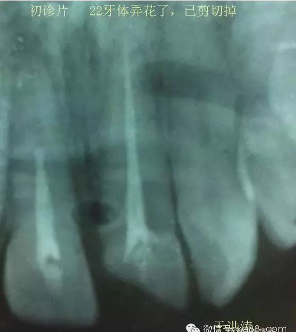 QQ圖片20150711104840.png QQ圖片20150711104840.png