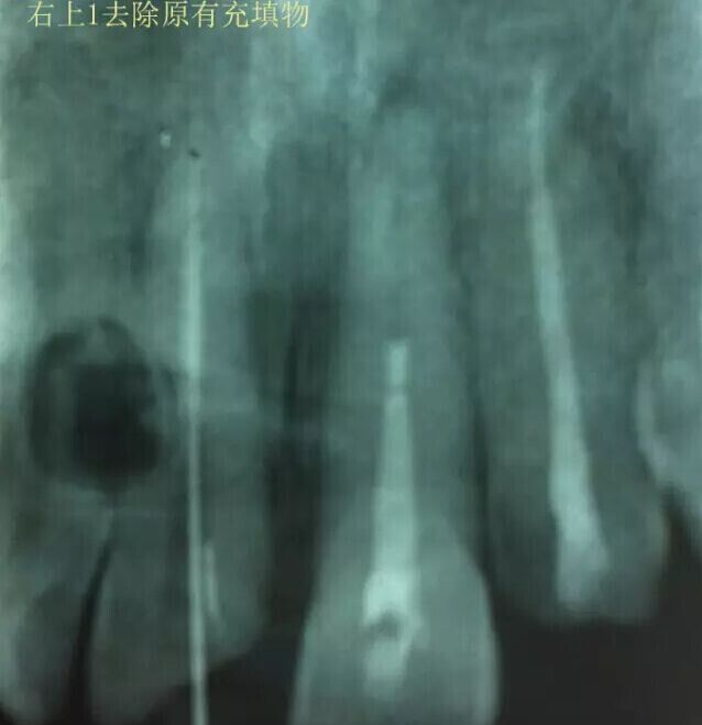 QQ圖片20150711104938.jpg QQ圖片20150711104938.jpg