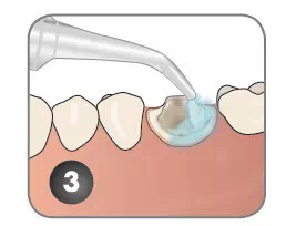 QQ圖片20150711153940.png QQ圖片20150711153940.png