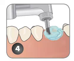 QQ圖片20150711153957.png QQ圖片20150711153957.png