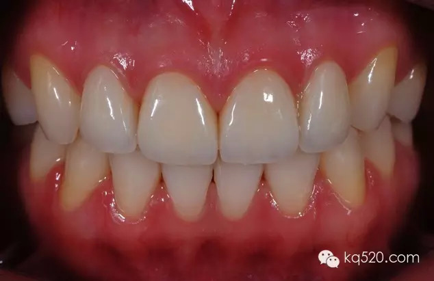 QQ圖片20150711155739.png QQ圖片20150711155739.png