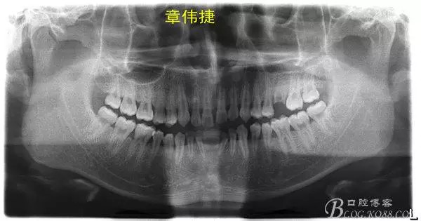 QQ圖片20150711161733.png QQ圖片20150711161733.png