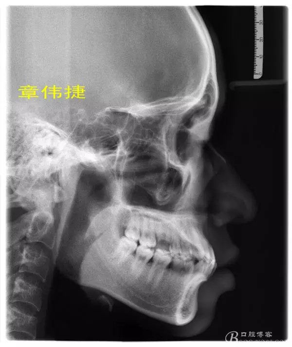 QQ圖片20150711161813.png QQ圖片20150711161813.png