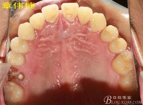 QQ圖片20150711161846.png QQ圖片20150711161846.png