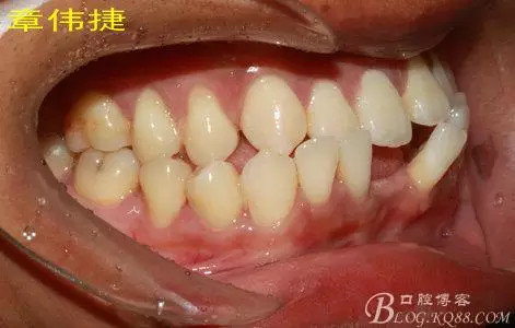 QQ圖片20150711161939.png QQ圖片20150711161939.png