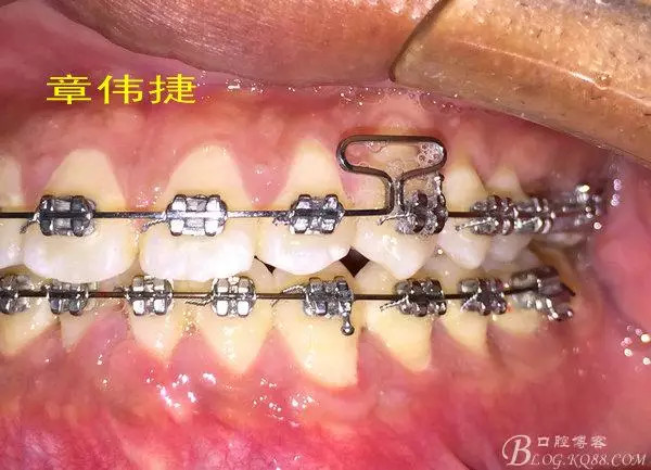 QQ圖片20150711162251.png QQ圖片20150711162251.png