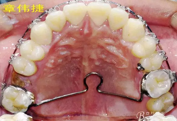 QQ圖片20150711162310.png QQ圖片20150711162310.png