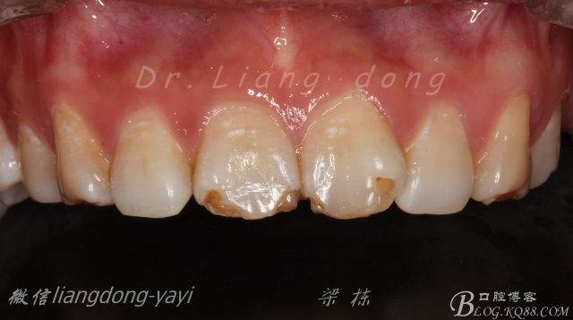 QQ圖片20150711164724.png QQ圖片20150711164724.png