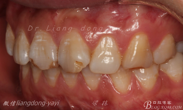 QQ圖片20150711164823.png QQ圖片20150711164823.png