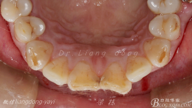 QQ圖片20150711164851.png QQ圖片20150711164851.png