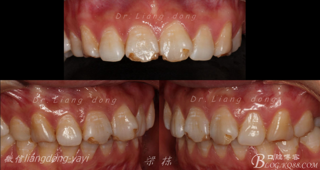 QQ圖片20150711164956.png QQ圖片20150711164956.png