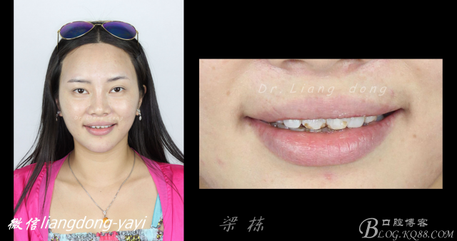 QQ圖片20150711165022.png QQ圖片20150711165022.png