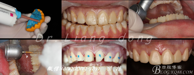 QQ圖片20150711165336.png QQ圖片20150711165336.png