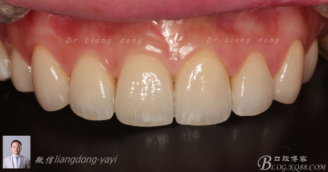 QQ圖片20150711165512.png QQ圖片20150711165512.png