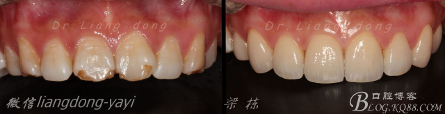 QQ圖片20150711165757.png QQ圖片20150711165757.png