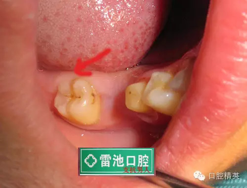 QQ圖片20150712091438.png QQ圖片20150712091438.png