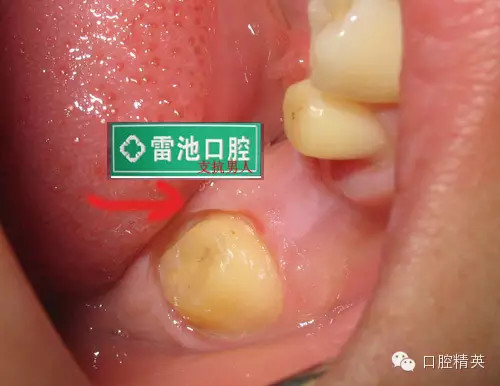 QQ圖片20150712091503.png QQ圖片20150712091503.png