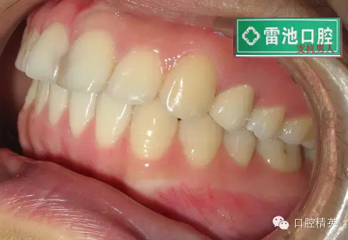 QQ圖片20150712091643.png QQ圖片20150712091643.png