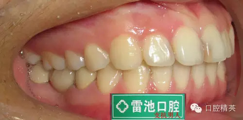 QQ圖片20150712091711.png QQ圖片20150712091711.png