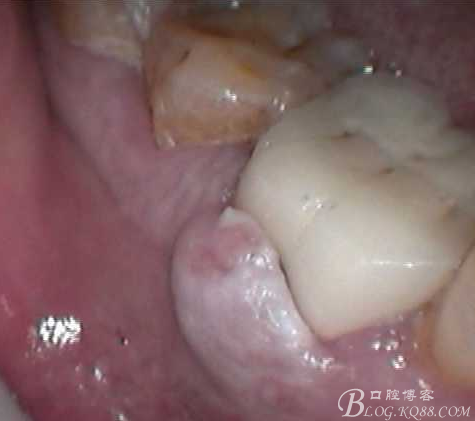 QQ圖片20150712103252.png QQ圖片20150712103252.png