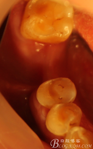 QQ圖片20150712103859.png QQ圖片20150712103859.png