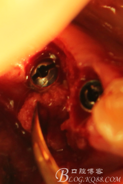 QQ圖片20150712104242.png QQ圖片20150712104242.png