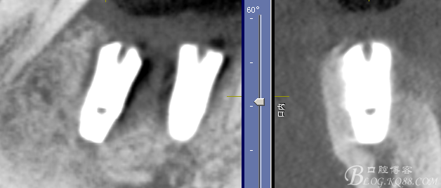 QQ圖片20150712104405.png QQ圖片20150712104405.png