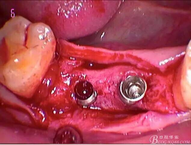 QQ圖片20150712104631.jpg QQ圖片20150712104631.jpg