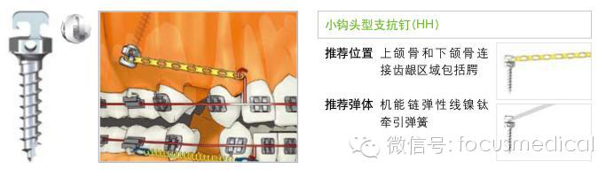 QQ圖片20150712111336.png QQ圖片20150712111336.png