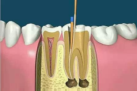 QQ圖片20150712113205.png QQ圖片20150712113205.png