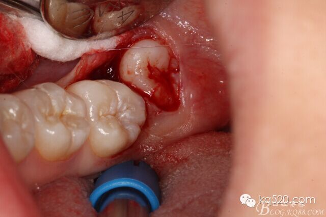 QQ圖片20150712143453.jpg QQ圖片20150712143453.jpg