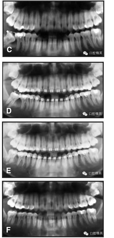 QQ圖片20150713105710.png QQ圖片20150713105710.png