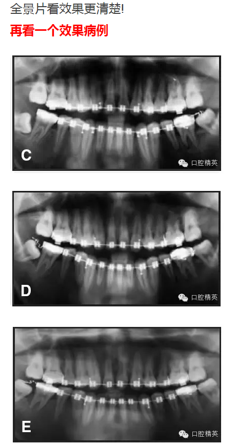 QQ圖片20150713105723.png QQ圖片20150713105723.png