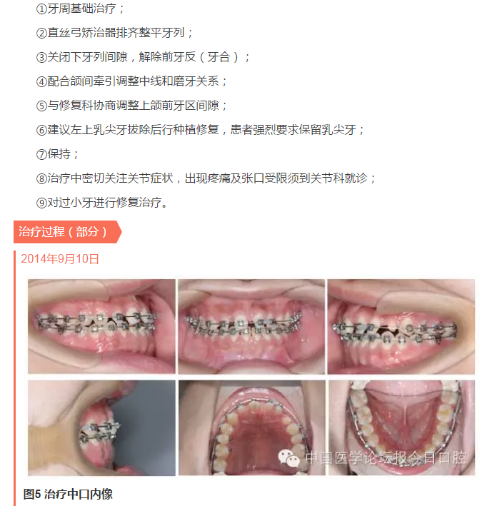 QQ圖片20150714135533.png QQ圖片20150714135533.png