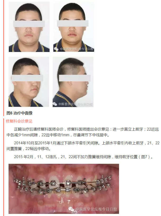 QQ圖片20150714135555.png QQ圖片20150714135555.png