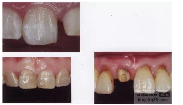 QQ圖片20150717111858.png QQ圖片20150717111858.png