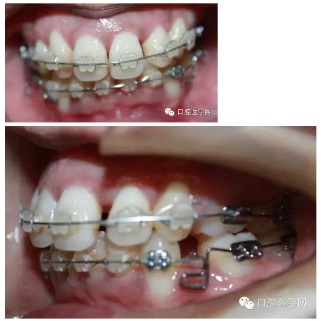 QQ圖片20150717171229.png QQ圖片20150717171229.png